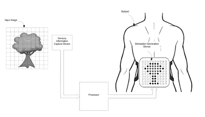 Image is a black and white illustration. It shows an image of a tree overlaid with a grid on the left. The illustration shows the process of taking the visual input of the tree as it moves through digital processes. On the left there is the torso of a man wearing a pad that covers the stomach area. On the pad is a representation of the tree shown on the left of the illustration.