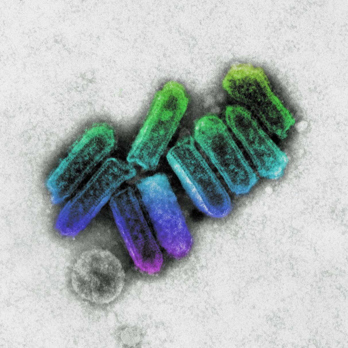 A transmission electron micrograph showing colorised bullet shaped Australian Bat lyssavirus particles