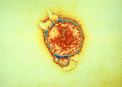 Mircoscopic slide of hendra, orange and yellow circle.