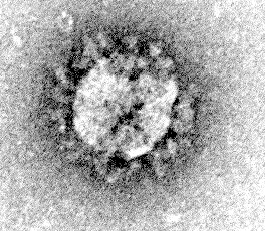 black and white microscope slide of SARS virus - large round fuzzy circle surrounded by odd celular shapes