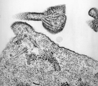 slide of nipah virus, black and white odd shaped cells