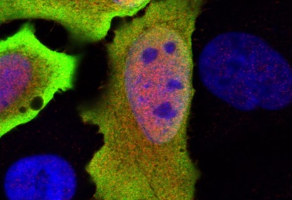 The ILRUN gene under a microscope