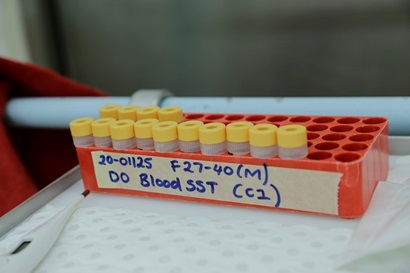 A red container holds rows of small vials with yellow lids. 