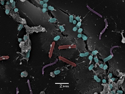 Electron micrograph of a variety of microbes attached to coal surface coloured in red, green and purple depending on type. 