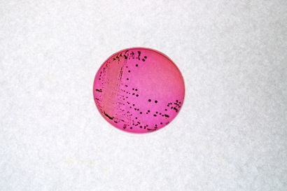 E coli bacteria colonies on a petrie dish