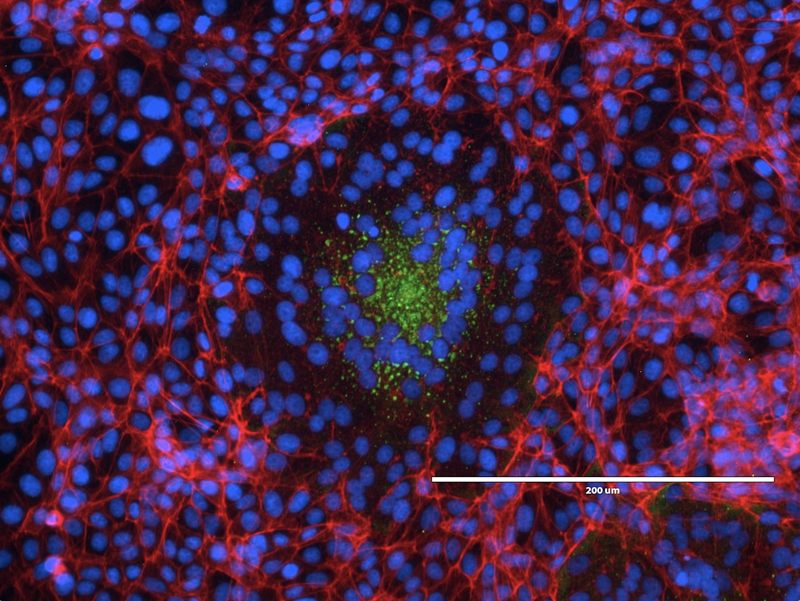 Vero Cells infected with Nipah virus, displaying cell fusion (known as syncytia) that is typical of Nipah virus infection.