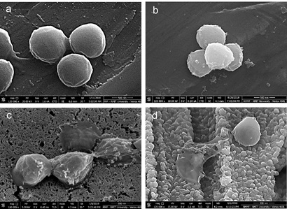 four black and white microscopic images of copper surface structure
