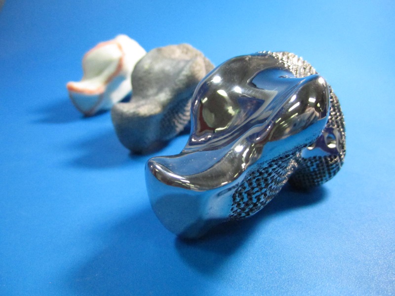 3D titanium heelbone implant