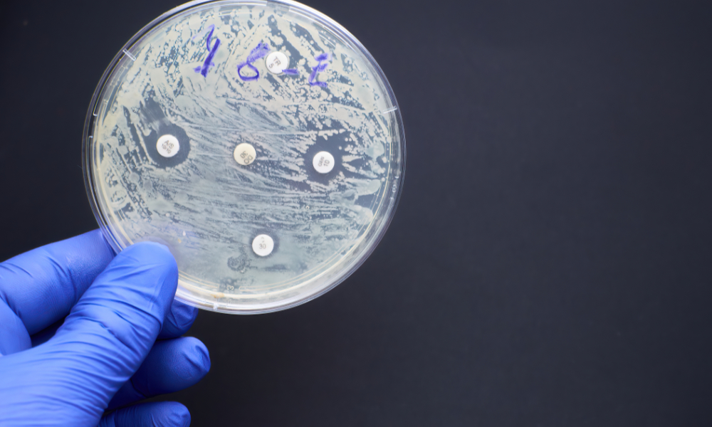 Curbing Antimicrobial Resistance - Vimarsana News