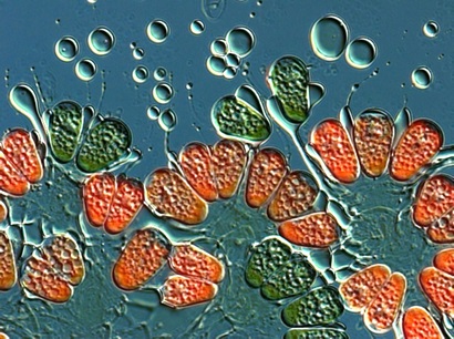 This image shows algae cells and oil droplets under the microscope. 