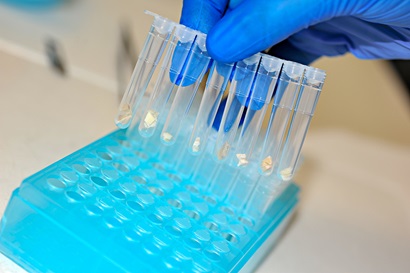 Hand holding tissue samples in test tubes