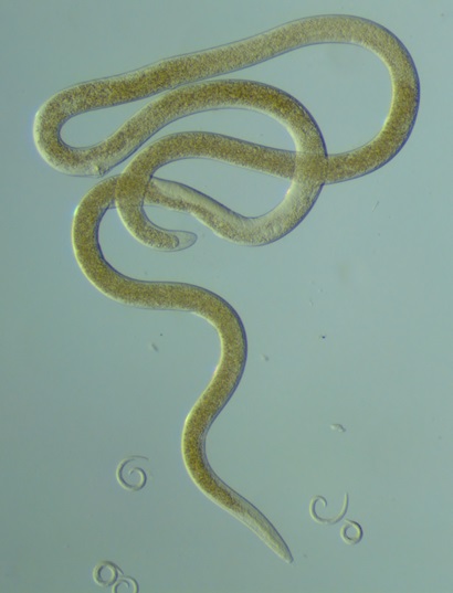 image of large and small nematodes