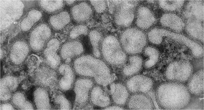 Grey shapes each with darker borders which are cells of the avian influenza virus, strain H7N9.
