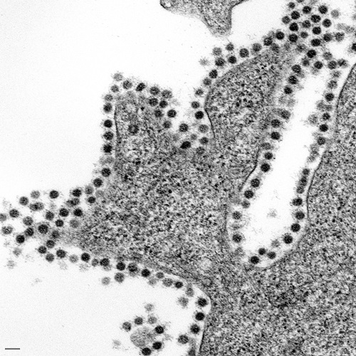 A micrograph of a thin section through part of a cell infected with the virus showing SARS-CoV
