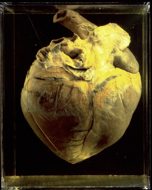 Phar Lap's heart on display at the National Museum of Australia.