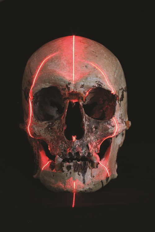 The ‘Baxter skull’ with CT scan lines.