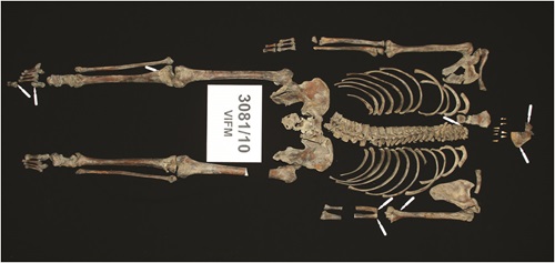 Ned Kelly’s skeletal remains