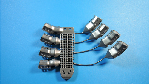 3D printed titanium sternum and rib implant.