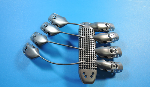 3D printed titanium sternum and rib implant.