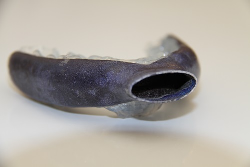 A 3D-printed titanium sleep apnoea device