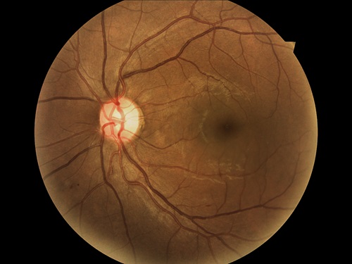 High-resolution image of a person's retina.