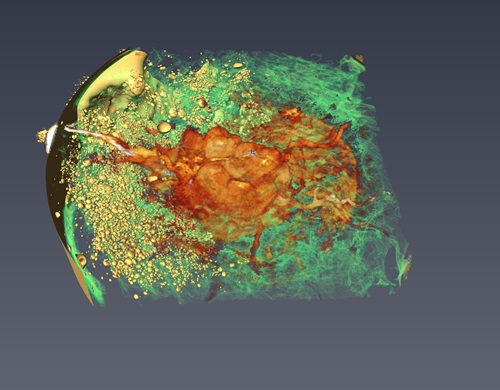 3D CT Reconstruction of an excised human breast.