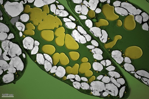 Plant oil seen under the microscope.