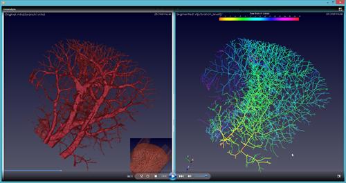 Screen shot of computer software tool showing blood vessels.