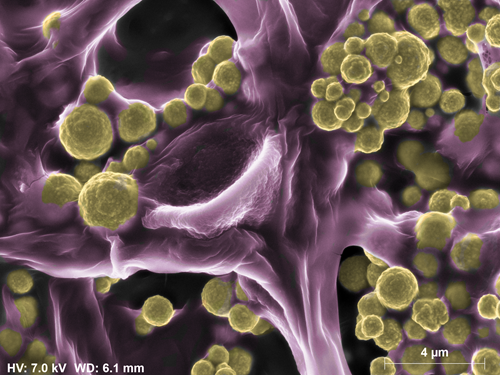 Coloured SEM image of the goldcoated Fusarium oxysporium fungi.