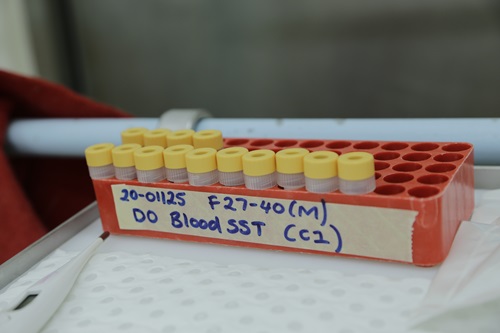 A number of sample tubes in a labelled tray. 