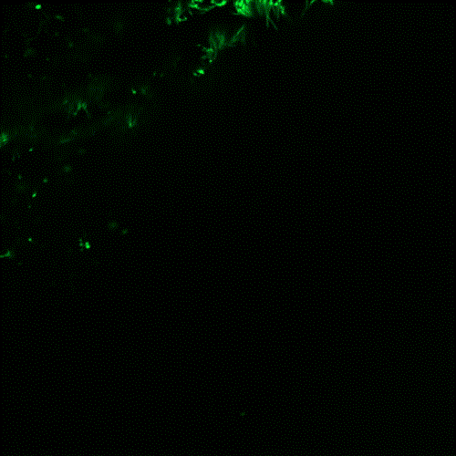 Cilia beating on the surface of labgrown ciliated cells stained for visualisation.