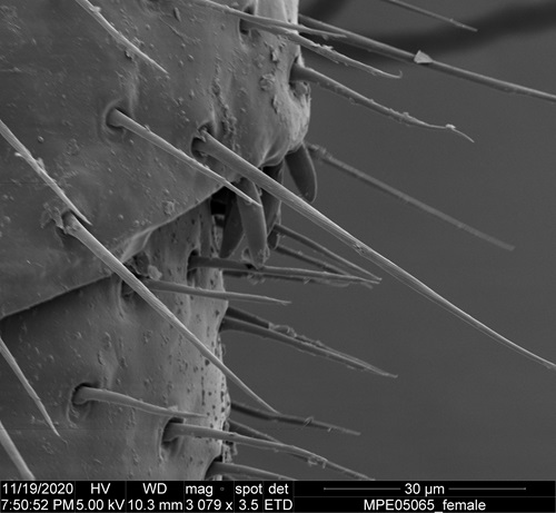 A very close up view of a female milipede's hair follicles