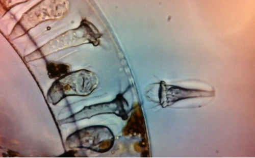 A band of transparent material with objects like screws inside the band. 