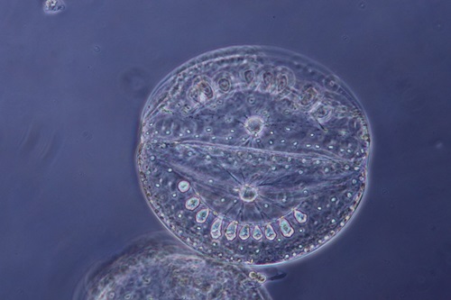 A transparent circular cell called a diatom.