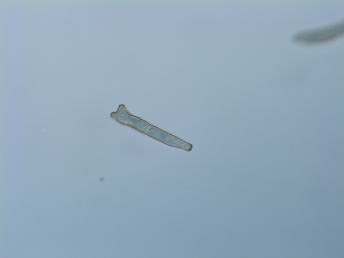 A fungus, Venturia paralias was found on the Atlantic coast of France