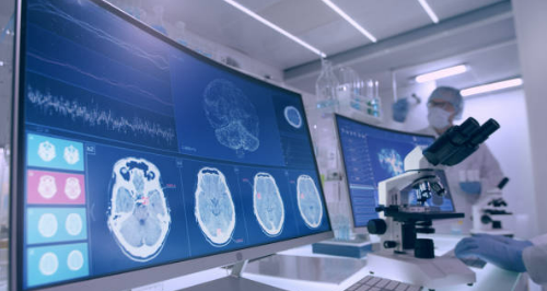 Researchers in a laboratory with microscope looking at images of a human brain.