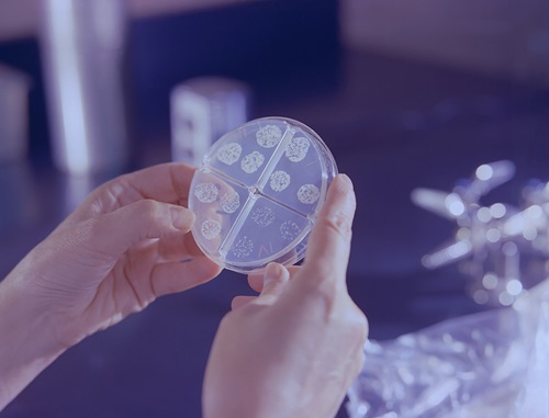 Drug susceptibility test