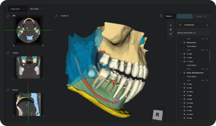 A 3D scan of a jaw showing different slices and features 