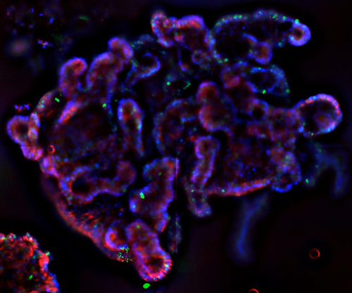 A human intestinal organoid under a microscope. 