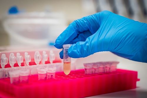 Person wearing blue gloves testing molecular samples in a lab. 