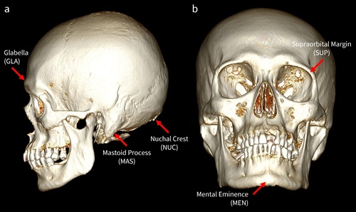 A volume-rendered CT scan featuring the five cranial traits used in the study.