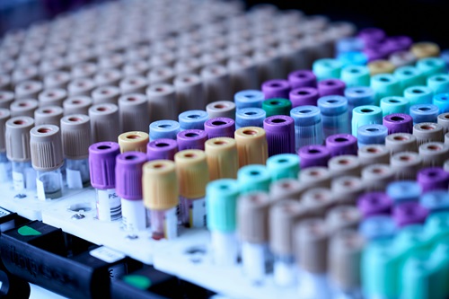 Close-up of multiple blood sample vials with various coloured caps — brown, purple, yellow, blue, and green — neatly arranged in a white rack, used for medical testing and research.