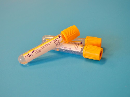 Three blood collection tubes with yellow caps on a blue surface.