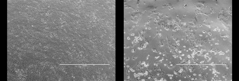 Uninfected (L): Healthy, uninfected bat kidney cells (from a species called Pteropus alecto). SGV infected (R): Bat cells infected with Salt Gully virus. The virus disrupts and damages as it grows from cell to cell, changing the cell shape and causing cell death as it spreads