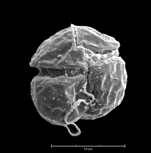 microscope image of algae