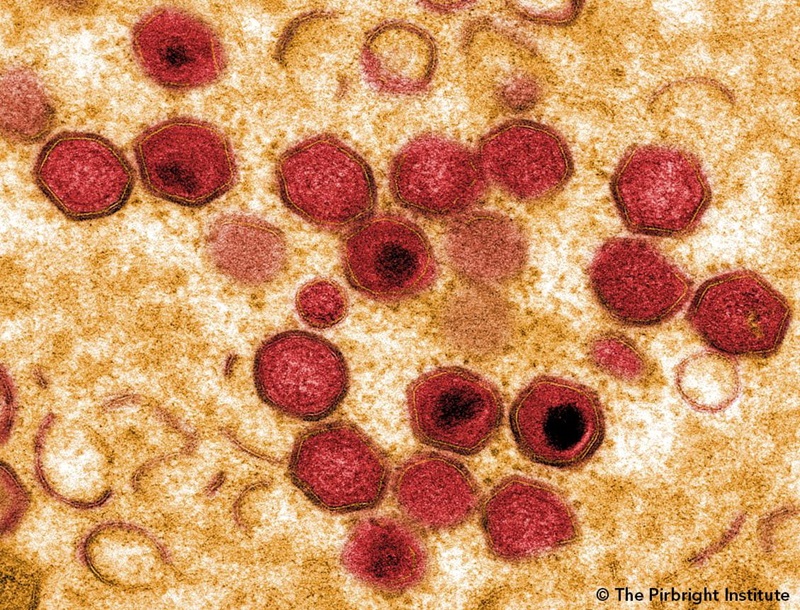 Microscopic coloured picture of hexagonal viruses.