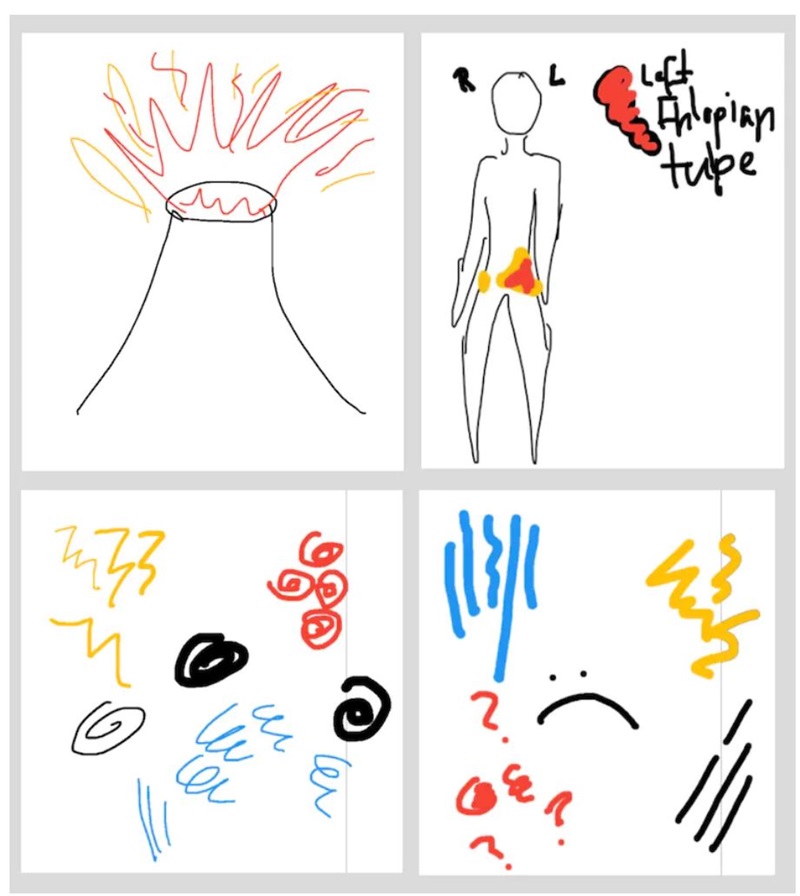 A series of abstract sketches conveying the experience of pain. 