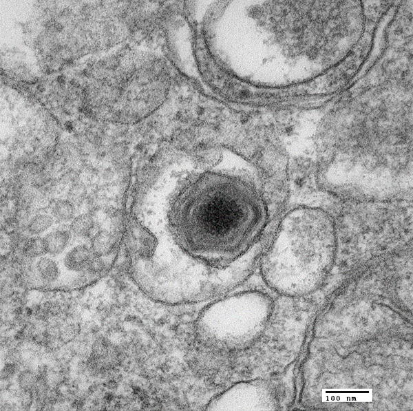 A black and white image of the african swine fever virus which looks like a black dot encased by rings with other empty cells surrounding it.