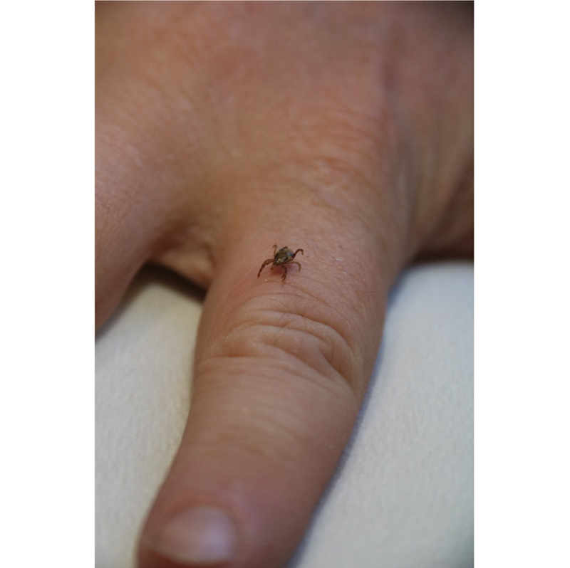 Eastern paralysis tick Ixodes holocyclus close up on hand 