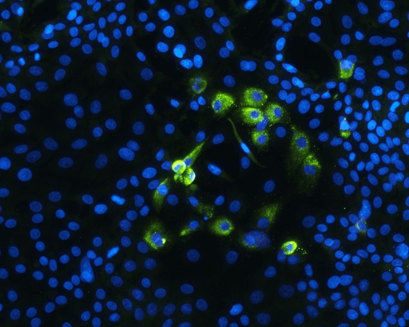 Close up of rabbit liver organoid cells. Virus genetic material in green. Cell nuclei in blue.